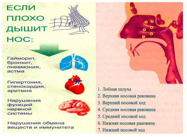 У ребенка не проходит насморк, что делать?