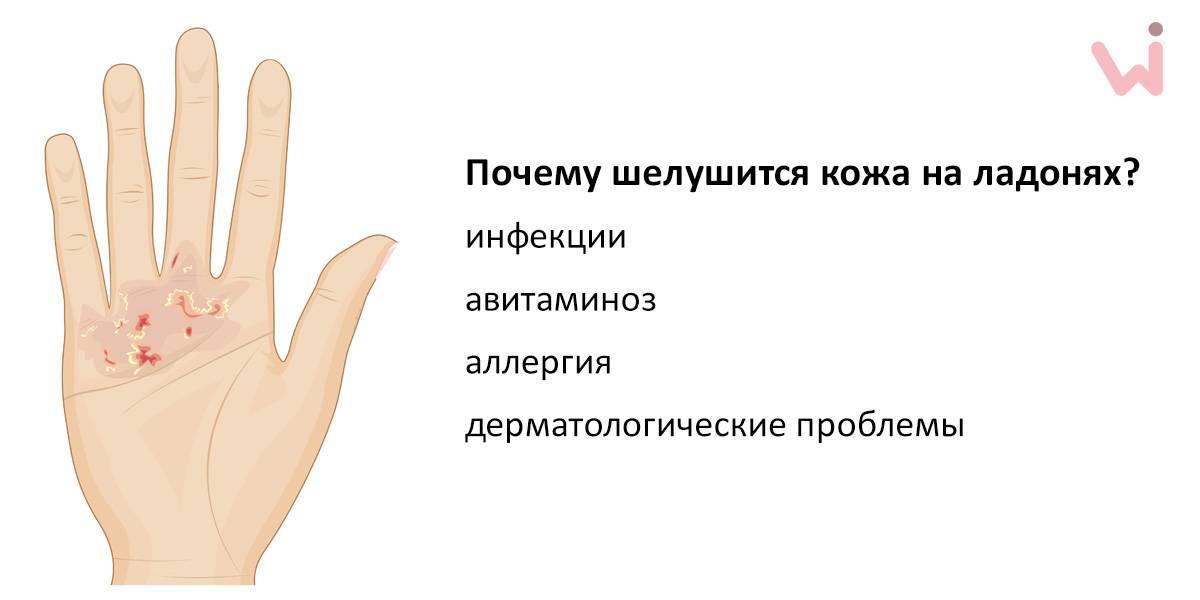 Почему у ребенка очень сухая кожа: причины и способы лечения