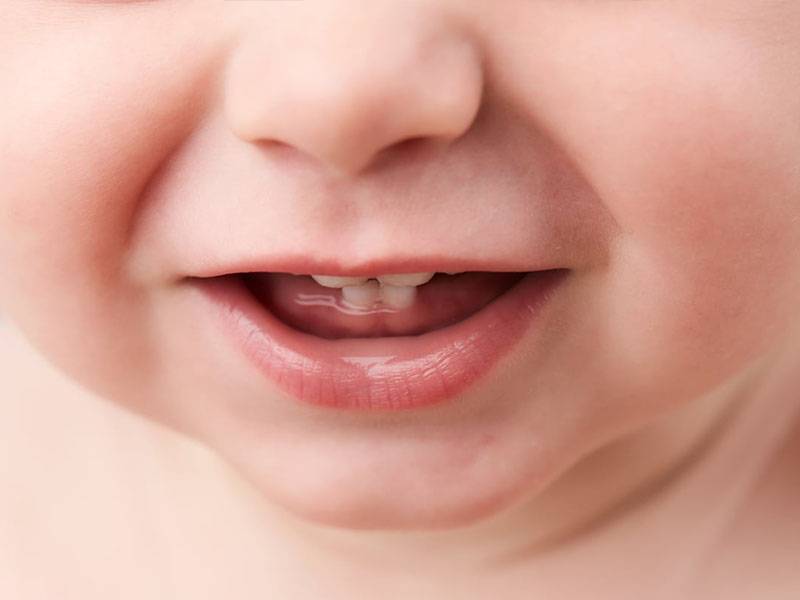 Прорезывание зубов у детей: 12 общих вопросов.