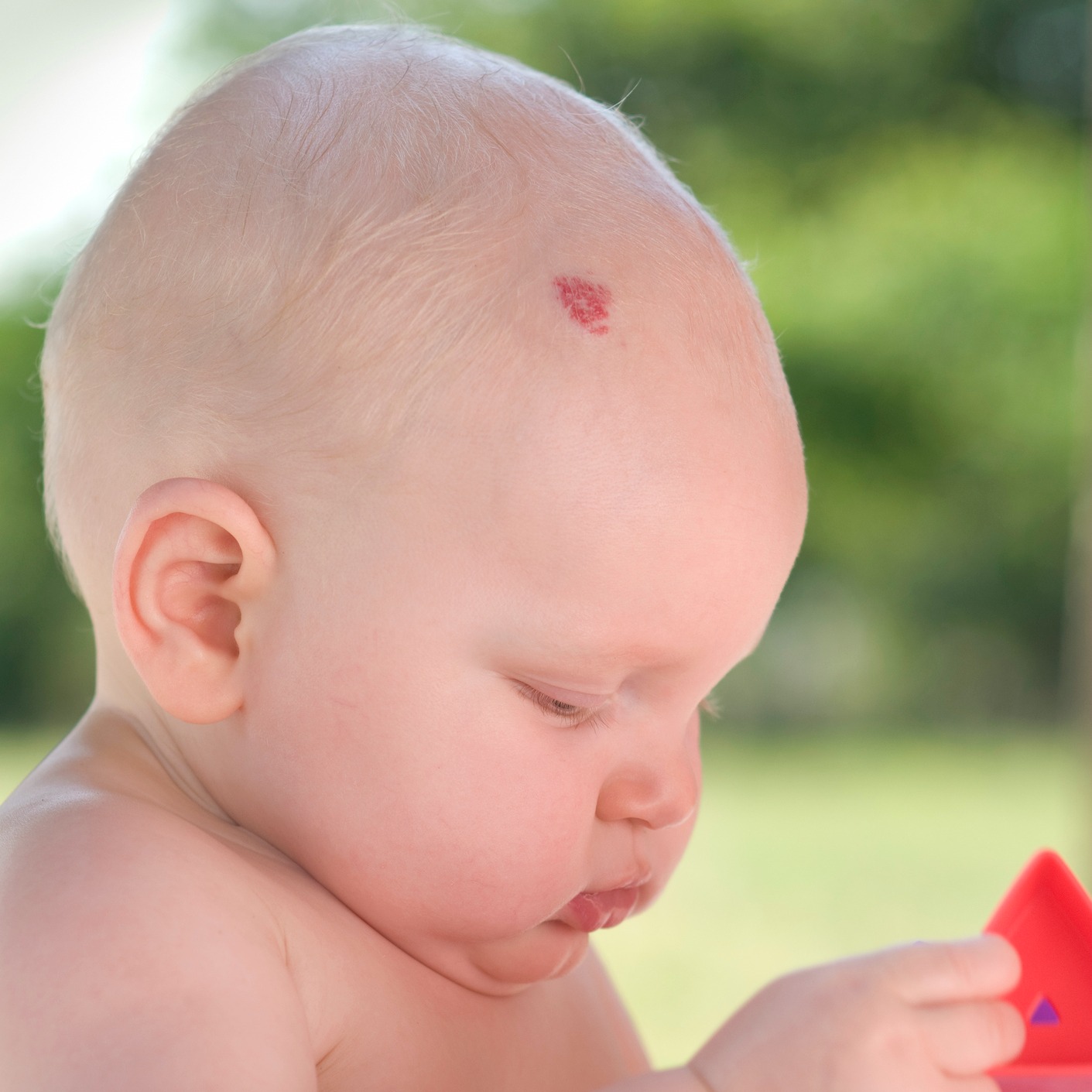 Родимые пятна у новорожденных: причины и виды | ru-babyhealth