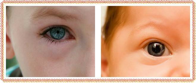 Мешки под глазами у ребенка — причины появления у младенцев