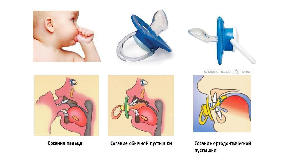 Сосет Кулачки