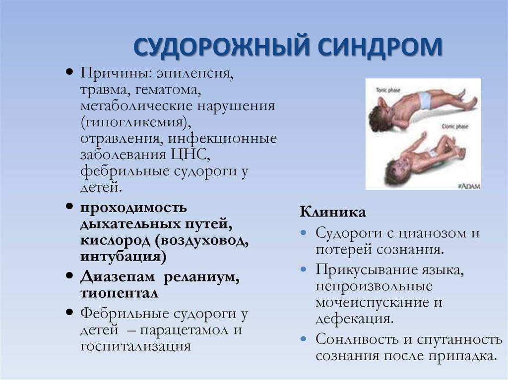 Признаки и причины возникновения эпилепсии у детей до года и старше, методы лечения заболевания