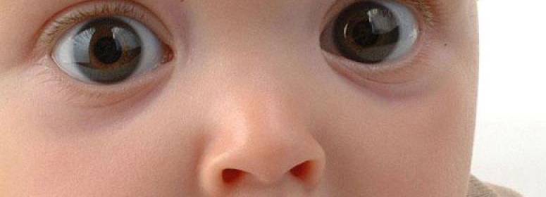 ᐈ почему у детей появляются синяки под глазами?| медицентр (доктор лор)