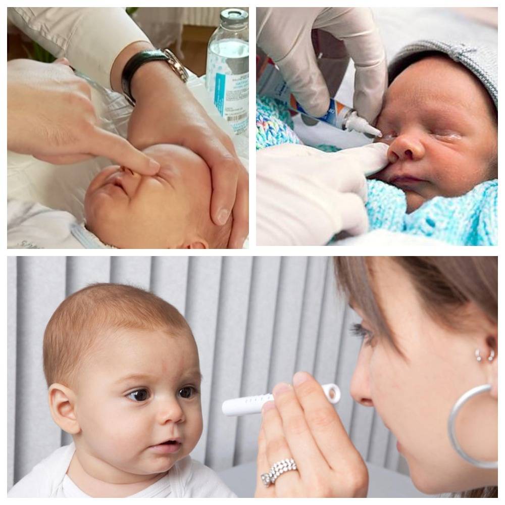 Родителям о дакриоцистите новорожденного  |  детская городская поликлиника №17