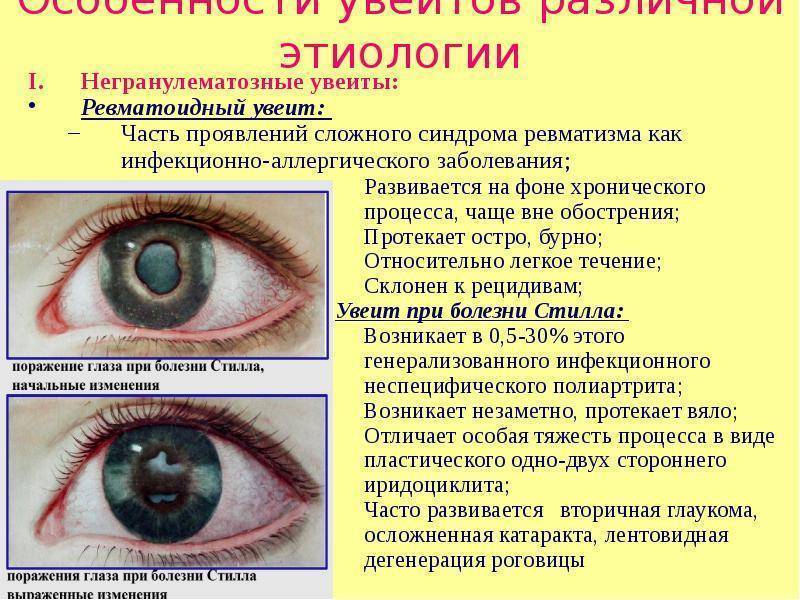 Болят глаза – симптомы, причины, лечение. что делать, когда болят глаза у ребенка?