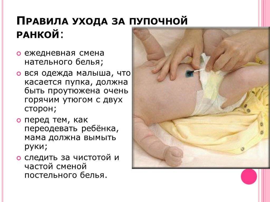 Как обрабатывать пупок новорожденного в домашних условиях?