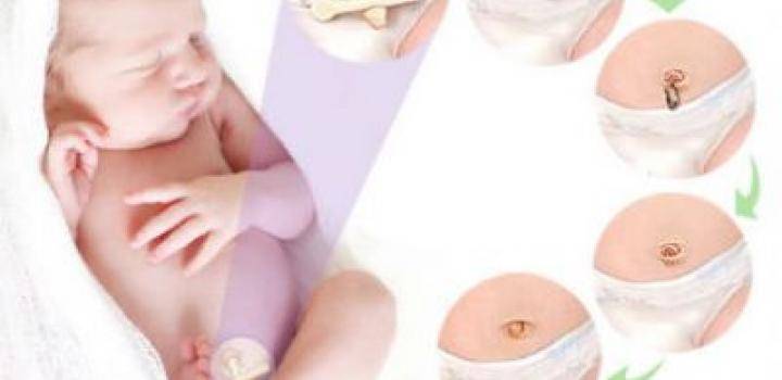 Обработка пупочной ранки у новорожденного ребенка в домашних условиях: алгоритм действий