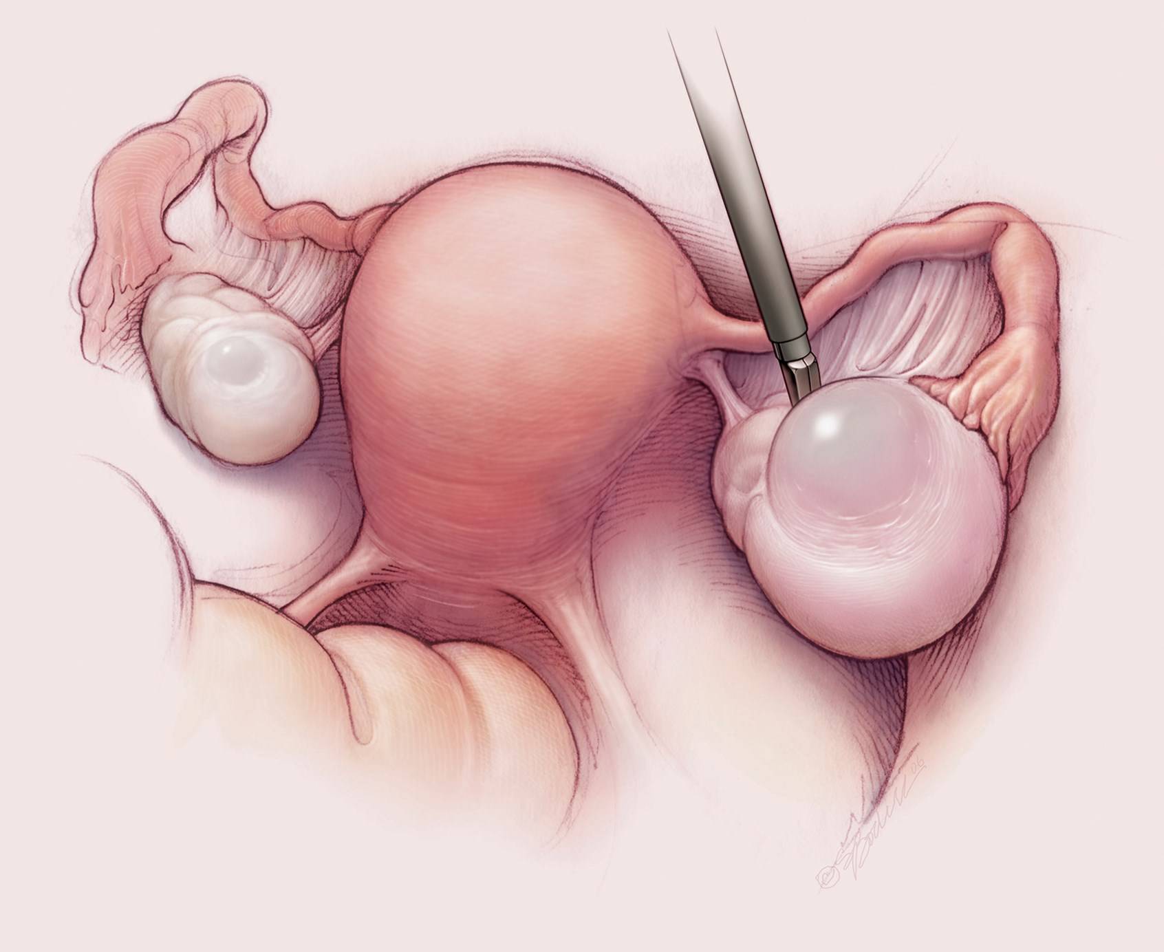 попадает ли сперма в матку при беременности фото 111