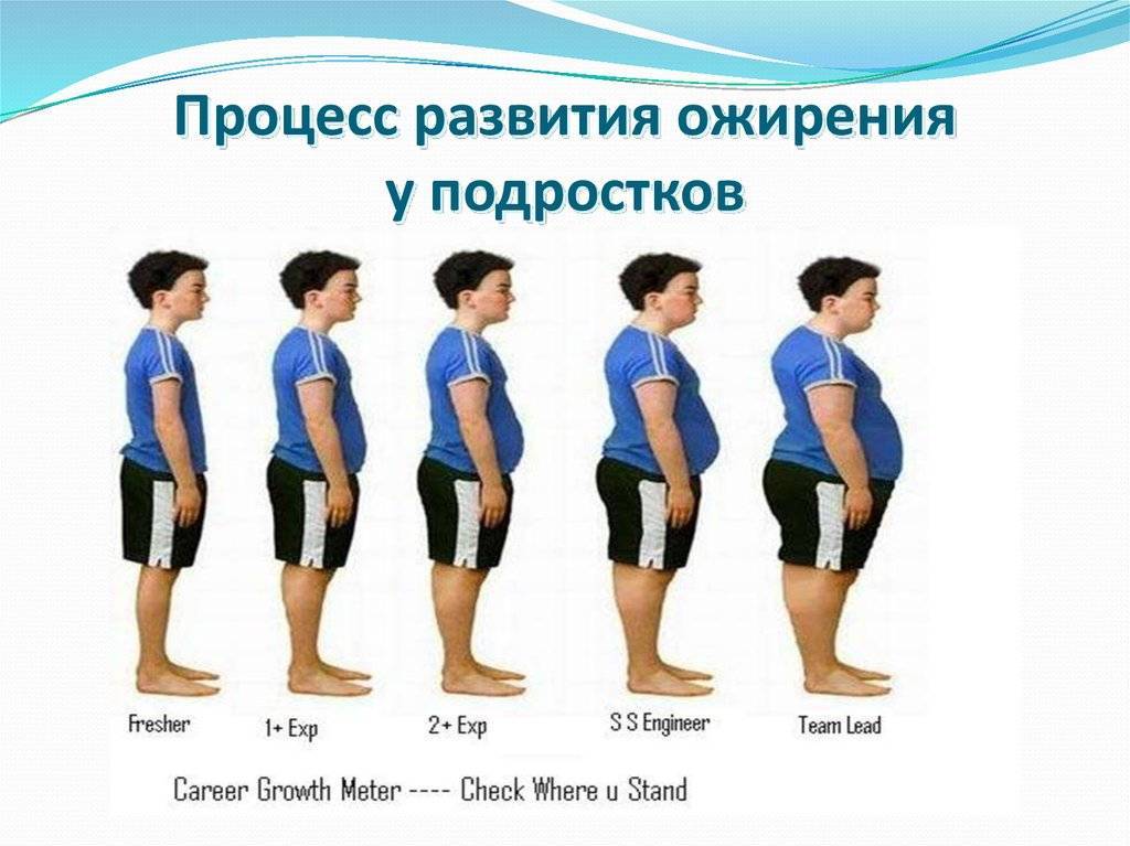 Лечение ожирения у детей