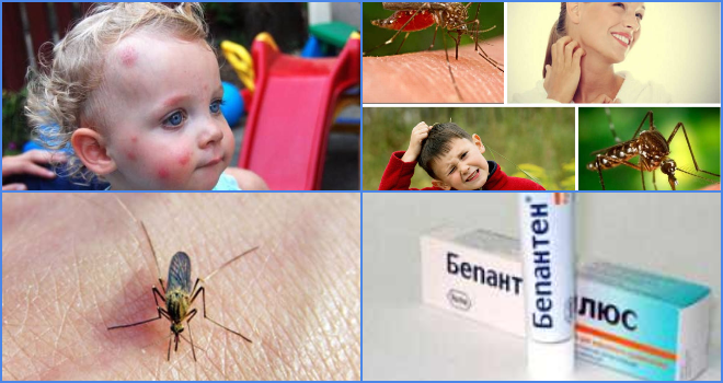 Укус комара у ребенка. чем помазать красные пятна на лице, руках и ногах от комариных укусов? средства защиты от комаров для детей