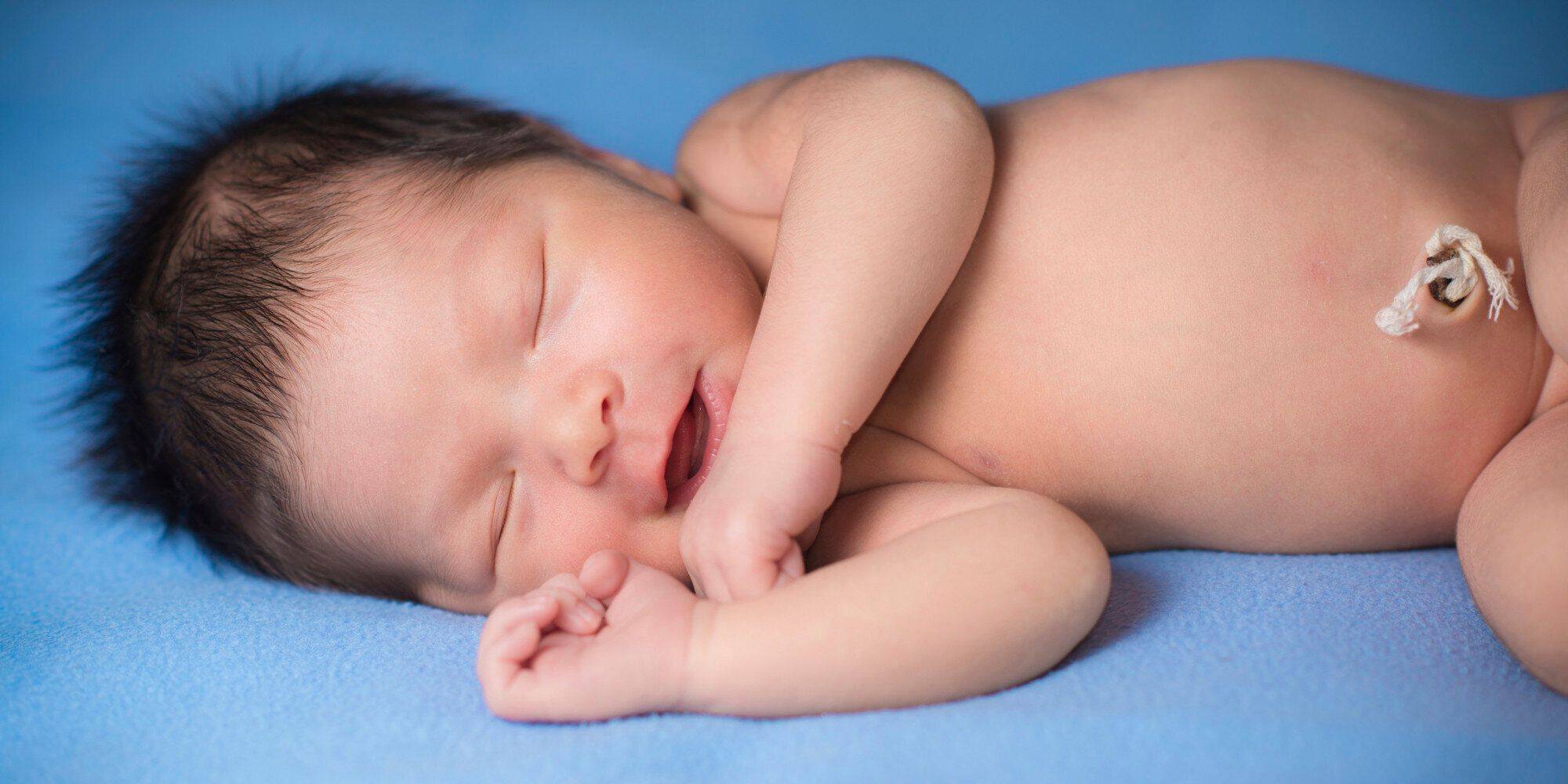 Кровит пупок у новорожденного: что делать, причины, меры профилактики