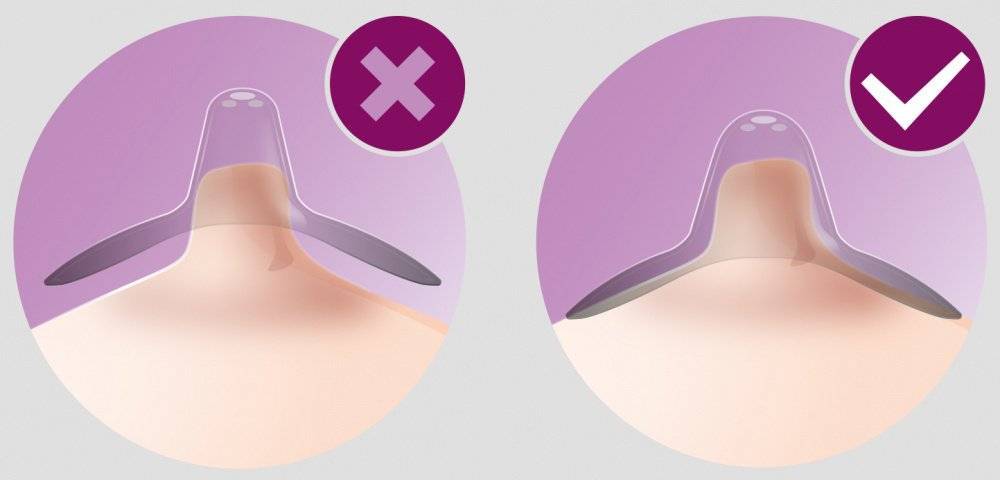 Накладки для грудного вскармливания: как подобрать | s-voi.ru