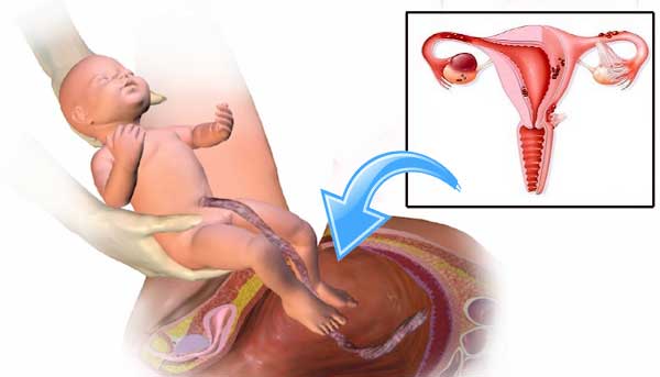 Естественные роды после операции кесарево сечение. когда можно, а когда нет? | аборт в спб