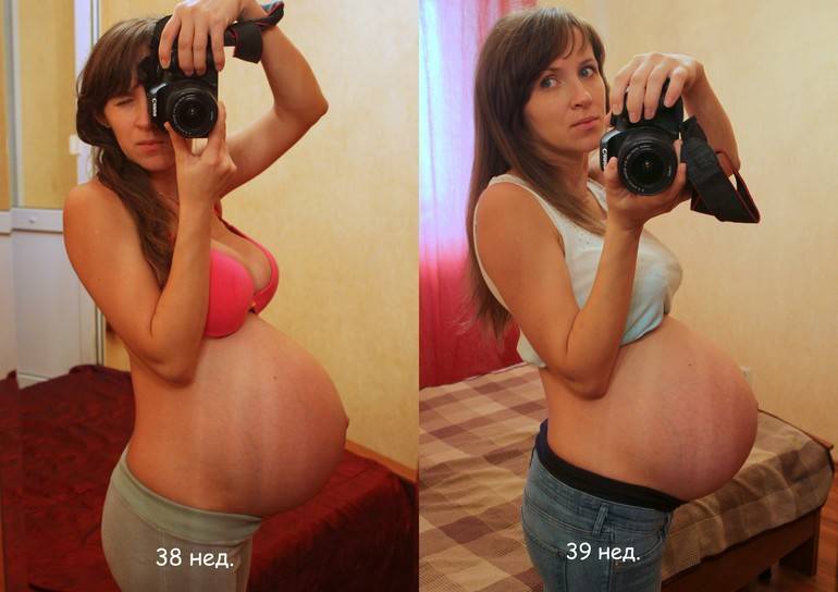 Беременность после 45 лет