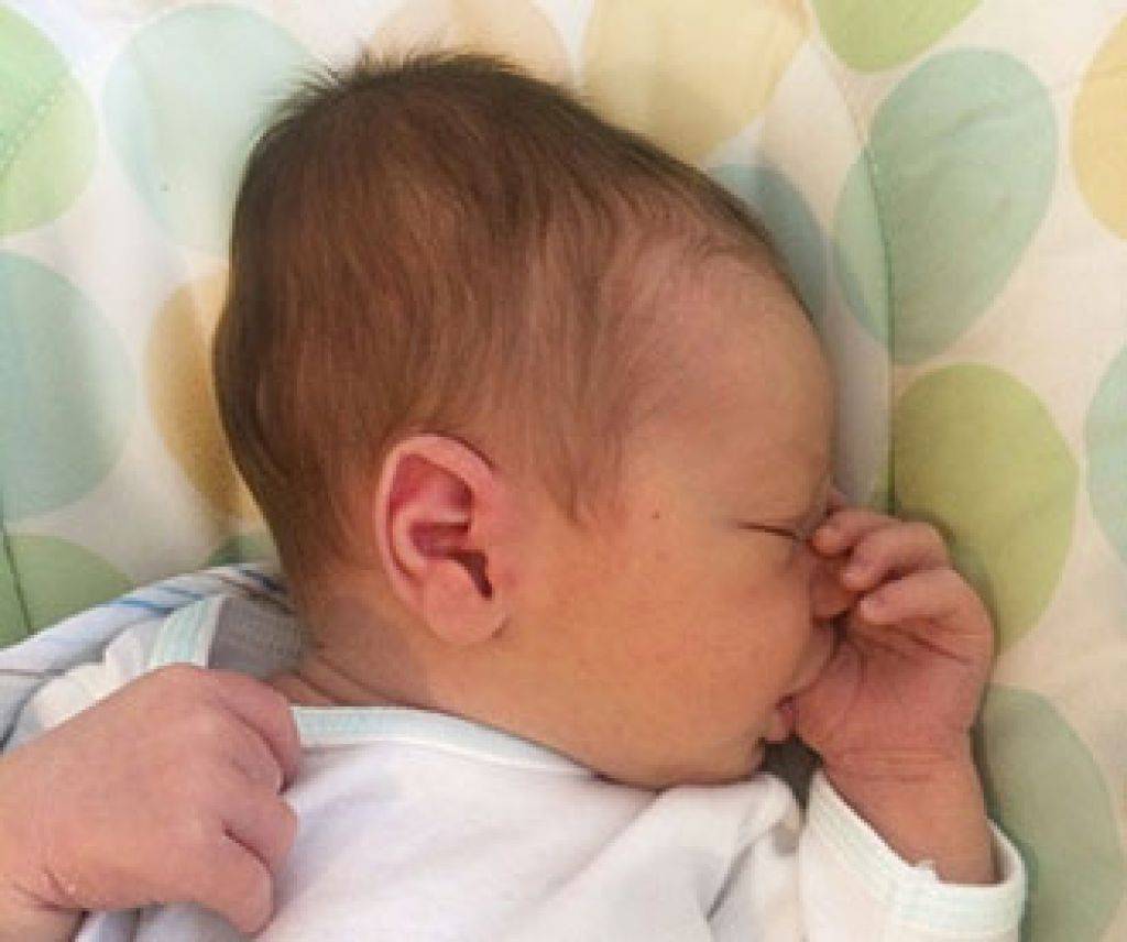 Гематома на голове у новорожденного ребенка после родов: когда проходит, последствия