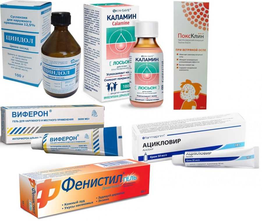 Ветрянка у детей | что делать? советы врача