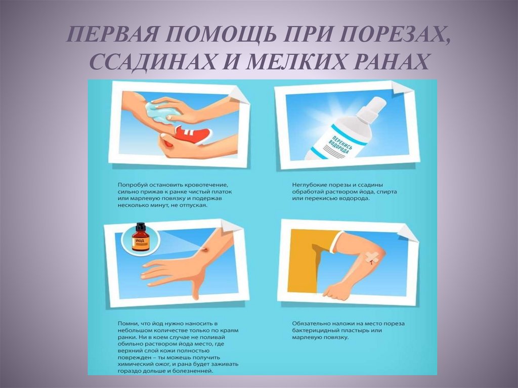 Чем обработать рану у ребенка после падения мокнущую, если кожа содрана и не заживает, как лечить?