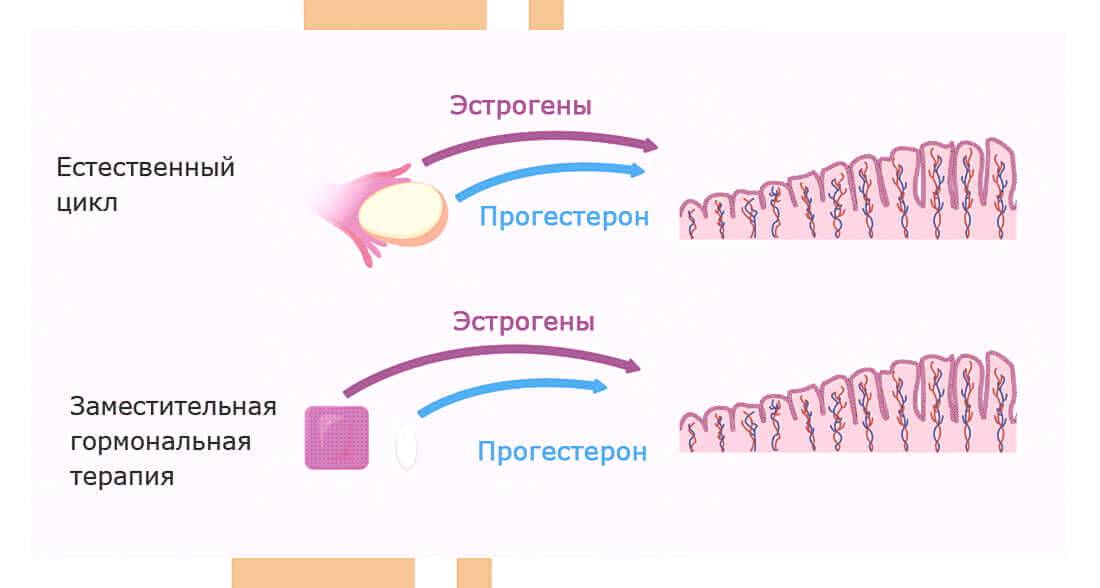 Криопротокол с згт схема