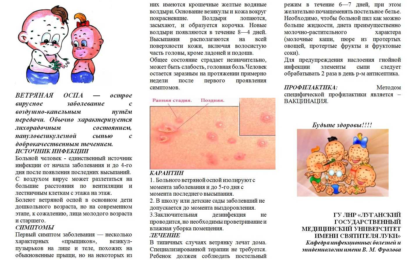 Ветрянка у детей и взрослых. сколько дней болеют ветряной оспой?