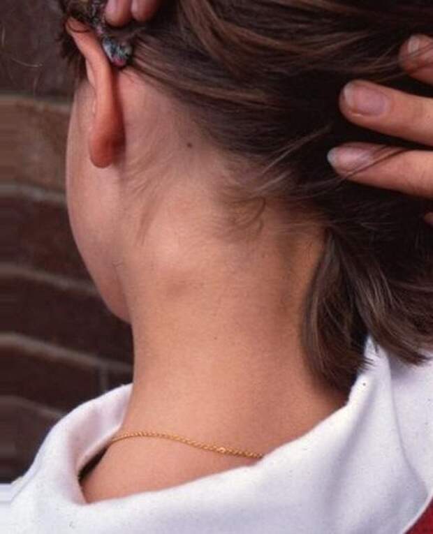 Шишка за ухом у ребенка: причины появления. лечение в твери