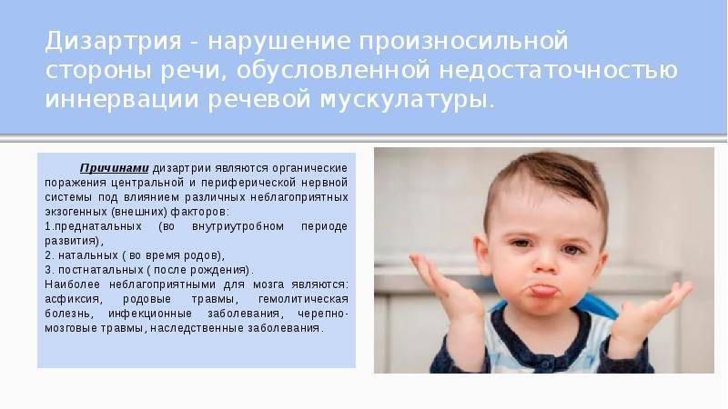 Лечение дизартрии у ребенка — 8 (499) 110-13-71