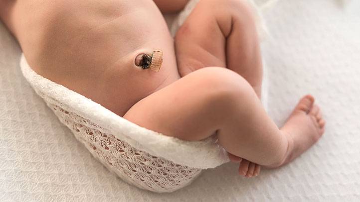 Кровит пупок у новорожденных: что делать и почему так происходит