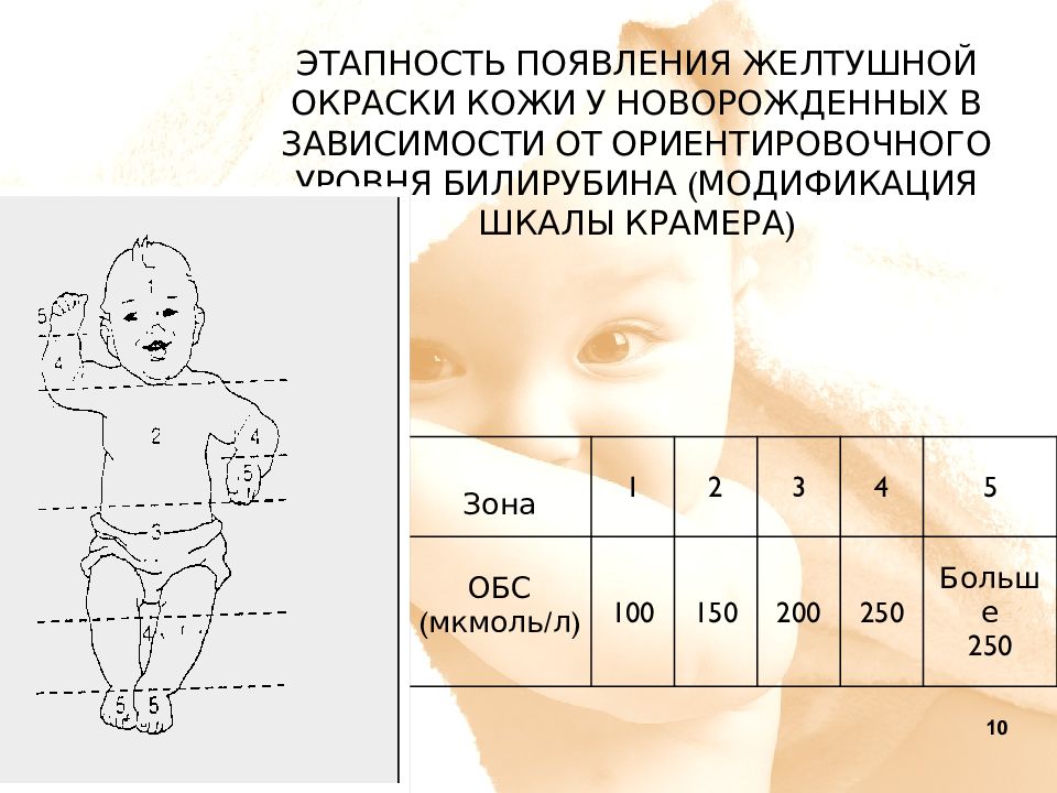 Почему повышен билирубин у новорожденного и как привести его в норму