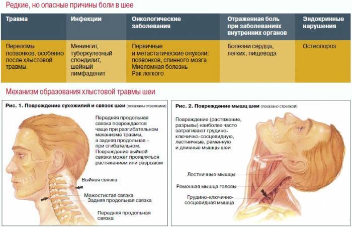 Болит шея после дтп