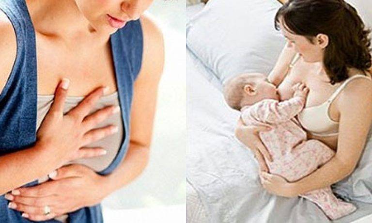 Что делать, если кормящая мама застудила грудную железу: симптомы и лечение “простуды груди” во время лактации