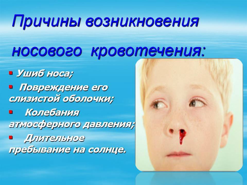 Слабость и носовое кровотечение. Причины носового кровотечения. Причины кровотечения из носа. Почему идёт кровь из носа.