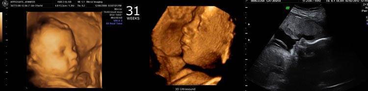 Фото малыша 33 недели беременности