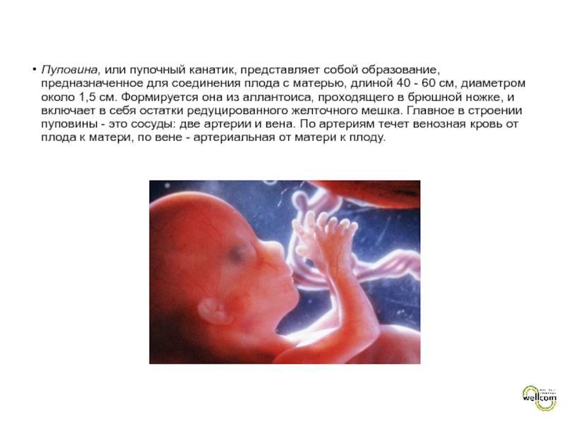 Аномалии пуповины при беременности   | материнство - беременность, роды, питание, воспитание