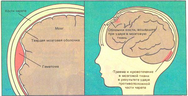 Ребенок ударился головой - на что обратить внимание, что делать