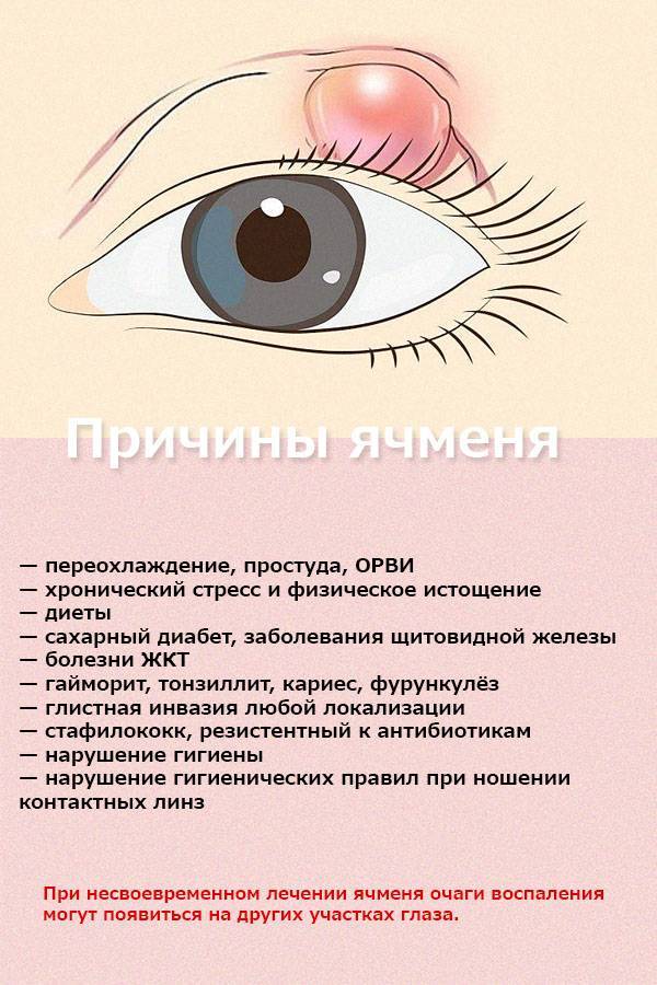 Внутренний ячмень на верхнем или нижнем веке глаза - причины и лечение - moscoweyes.ru - сайт офтальмологического центра "мгк-диагностик"