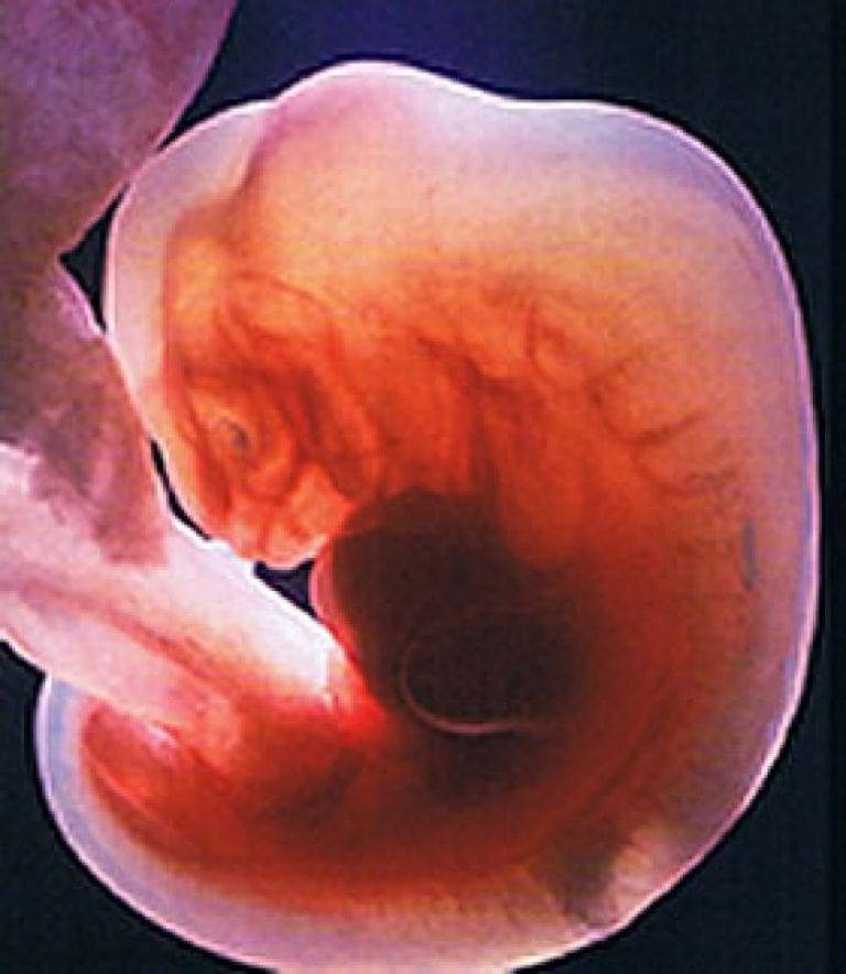 Признаки беременности на 1 неделе: симптомы после зачатия, ощущения, фото