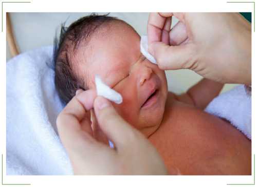 Зондирование слезного канала у новорожденных и младенцев: видео