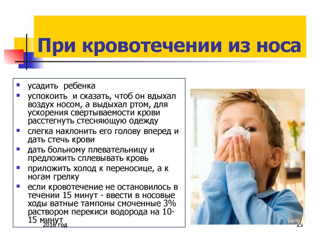 Почему у ребенка идет кровь из носа, первая помощь, лечение