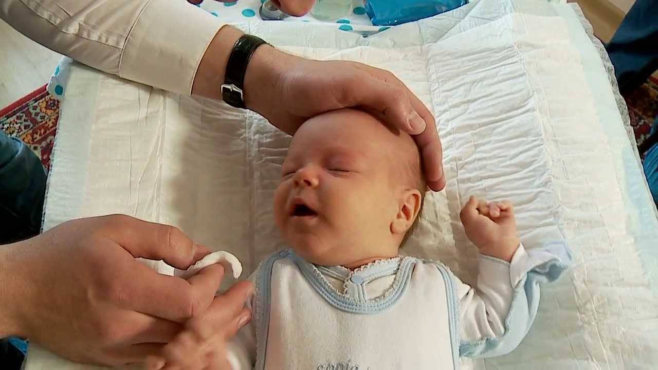 Зондирование слезного канала у новорожденных и детей до года: видео, последствия операции