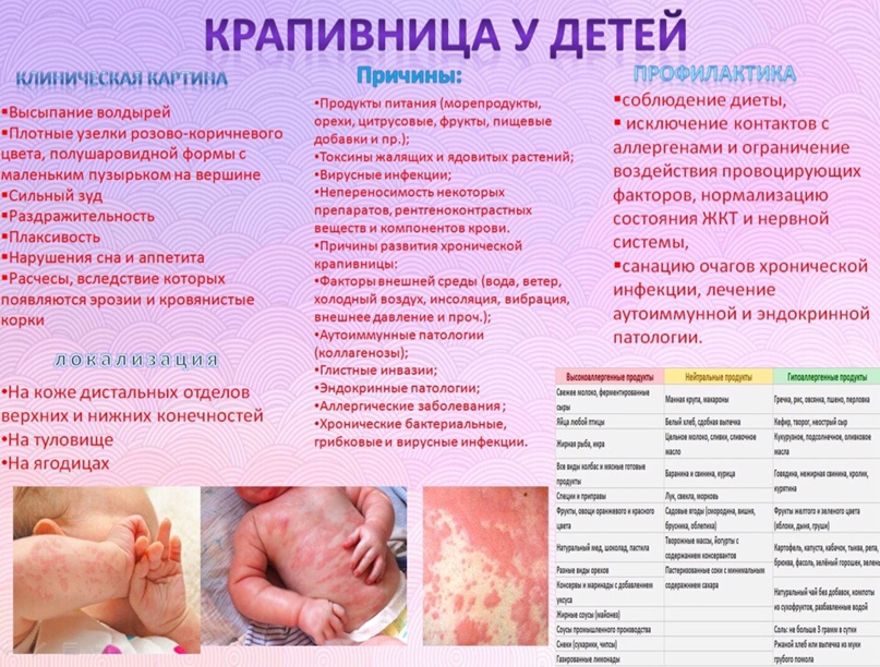 Крапивница у детей: симптомы и лечение, профилактика фото