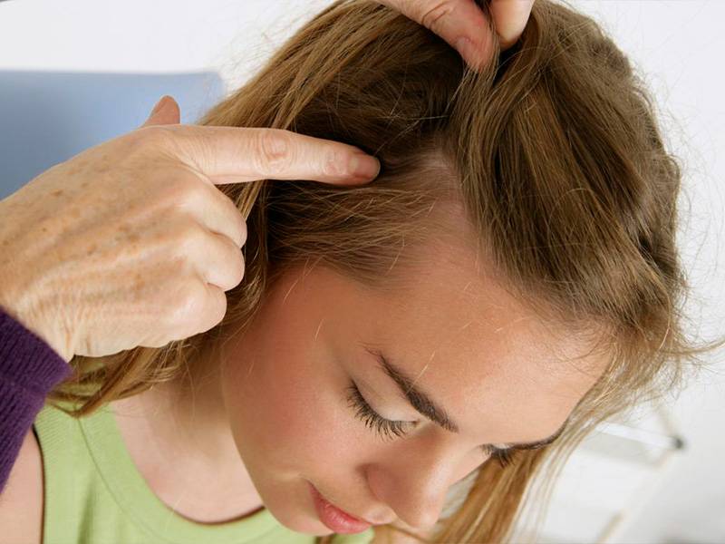 Причины выпадения волос у подростка. Раздражённая кожа головы. Заболевания волосистой части головы.