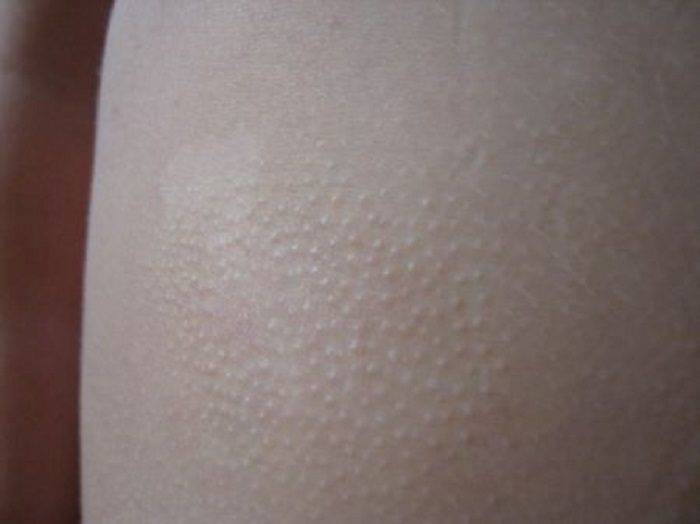 Почему у ребенка шелушится кожа — причины шелушения кожи у детей