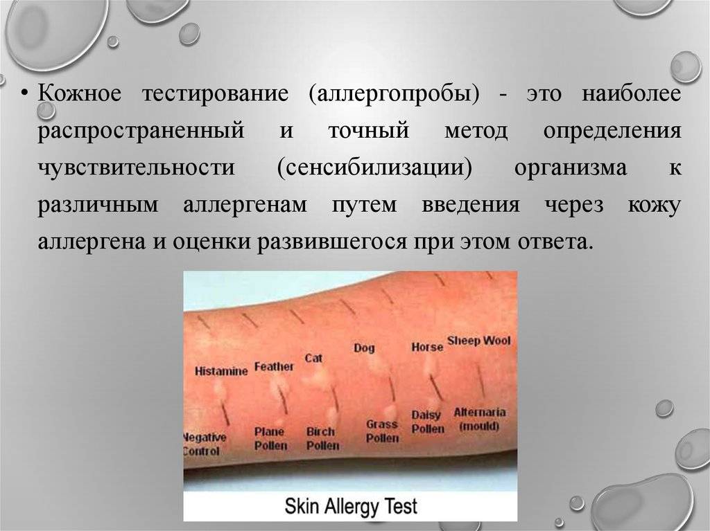 Анализ определяющий аллергию | как определить аллергию | гемотест
