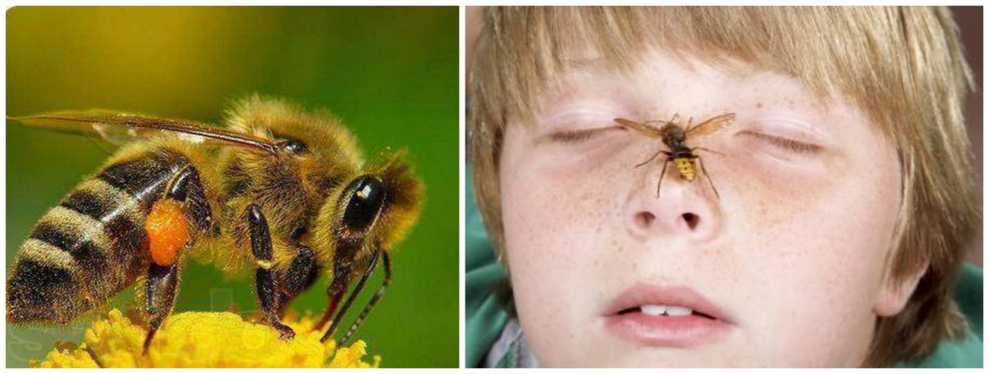 Ребенка укусила оса или пчела - что делать в домашних условиях, как выглядит след на фото?
