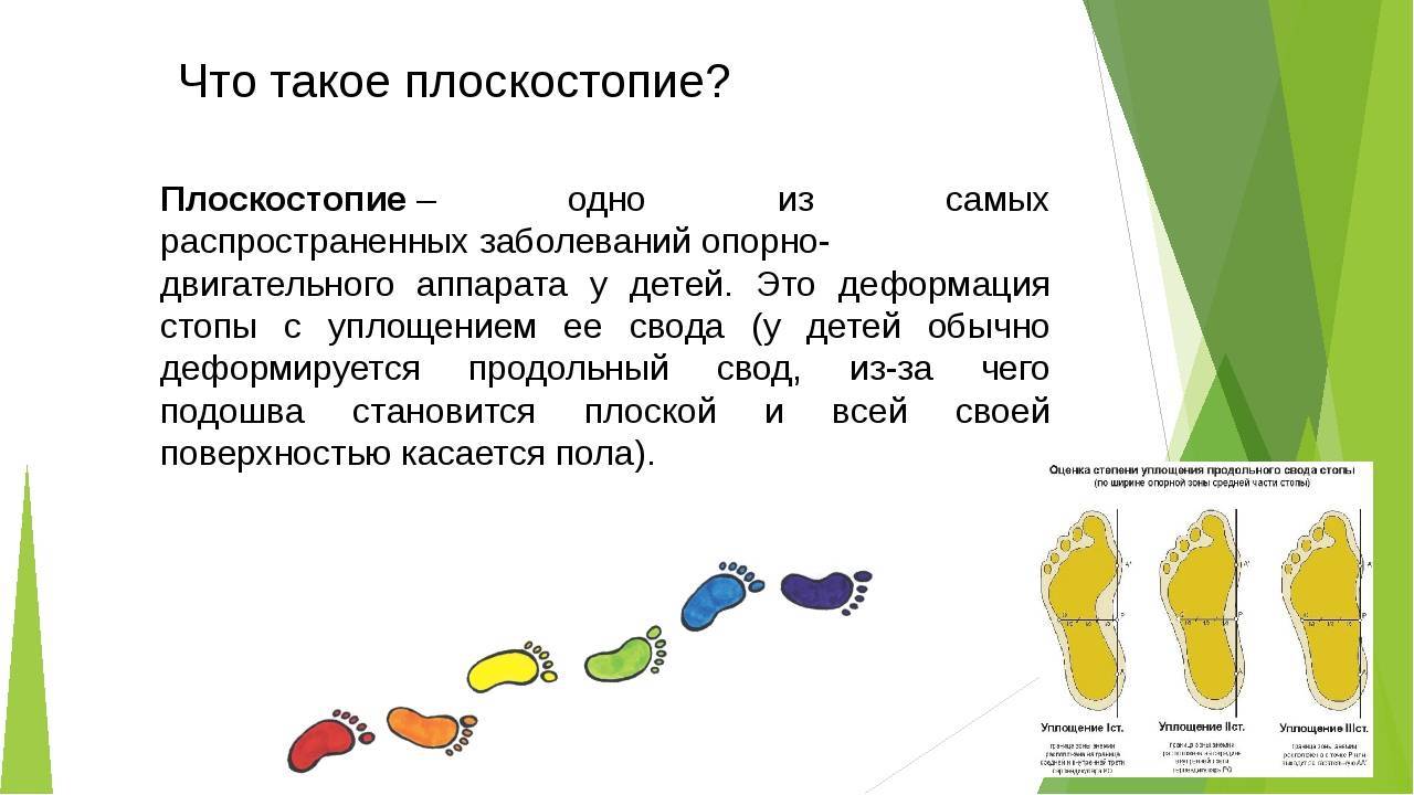 Профилактика плоскостопия презентация