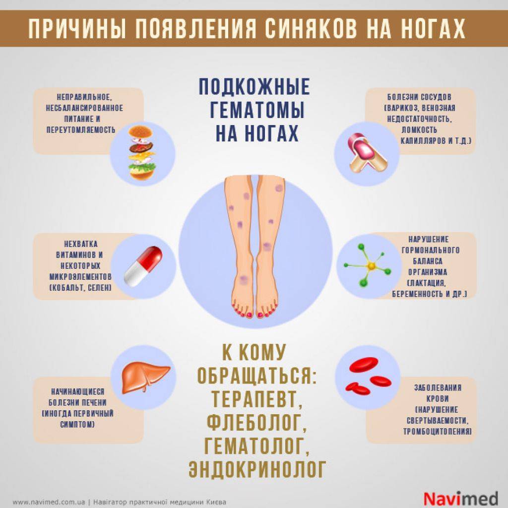 Экзема на ногах - эффективное лечение, причины и симптомы заболевания