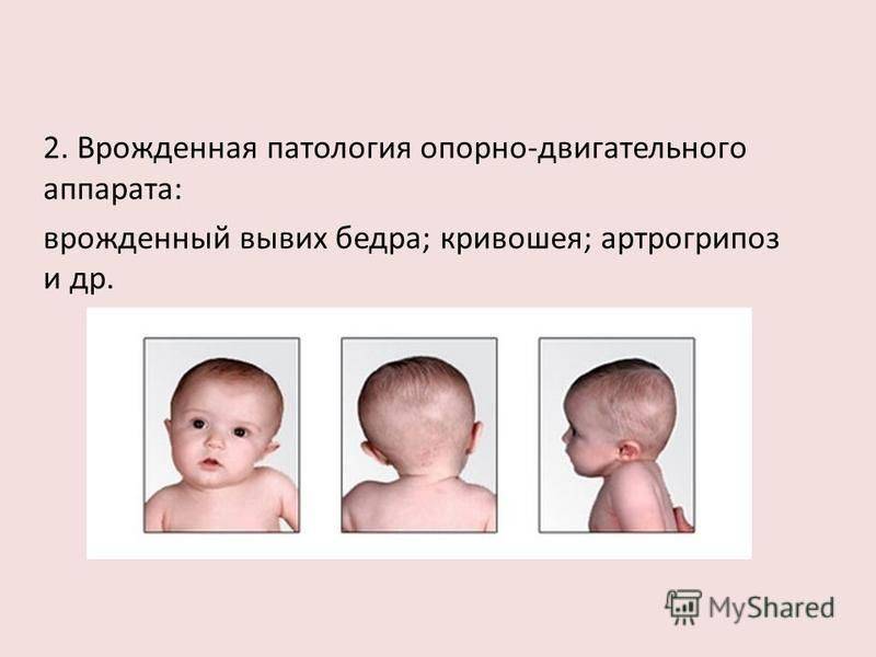Анатомия черепа новорожденного человека – информация: