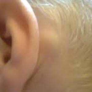 Что означает появление шишки за ухом на кости у ребенка: причины и лечение уплотнений