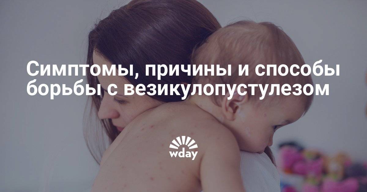 Энтеробиоз у детей