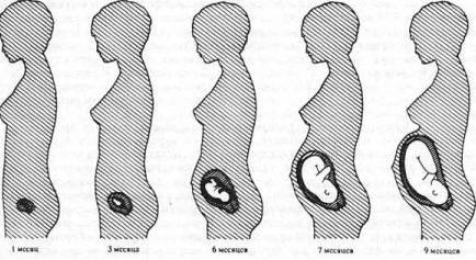 Многоплодие: признаки и патологии многоплодной беременности